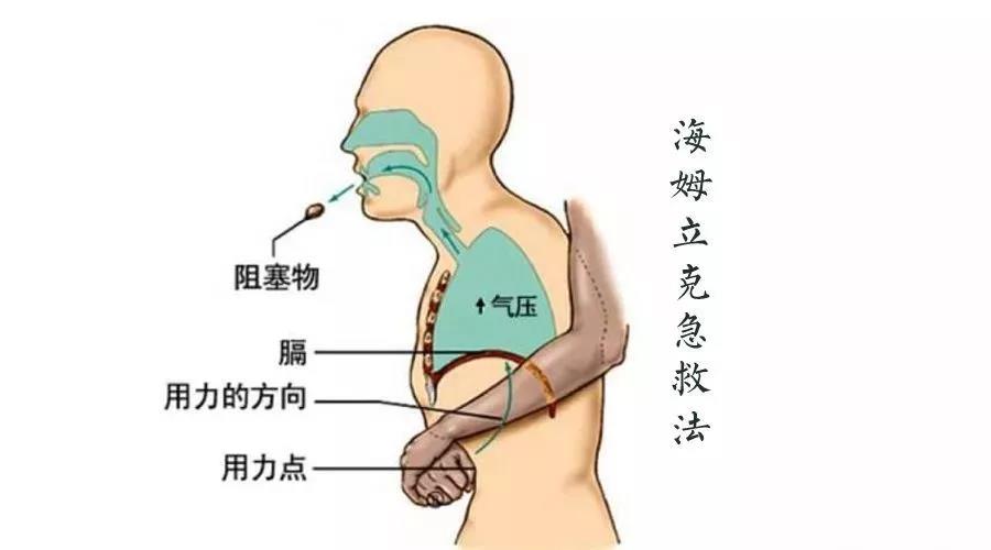 巡逻中突遇幼儿噎食民警用海姆立克急救法成功救助