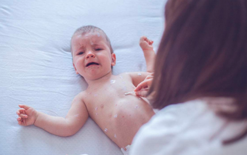 婴儿红疹平时怎么护理?缓解只需这几招!: