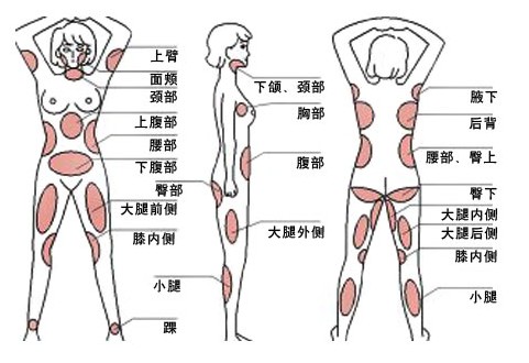最常见的全身吸脂部位有:面颊,双下巴,颈部,肩背,四肢,腰腹,上臀等.