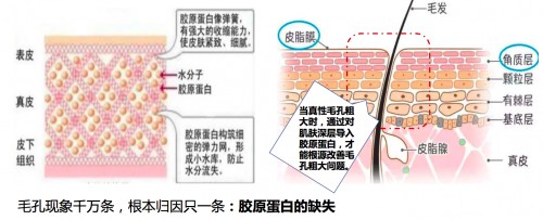 毛孔粗大怎么修复,樊文花细致毛孔方案套全评测
