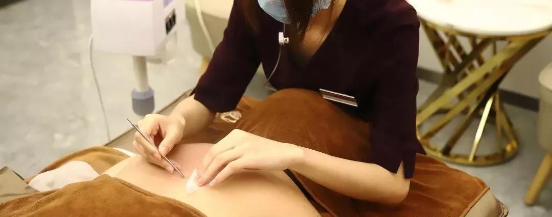 资讯 ibeautys净白去印背部护理 祛痘 消炎 结合皮肤情况进行治疗