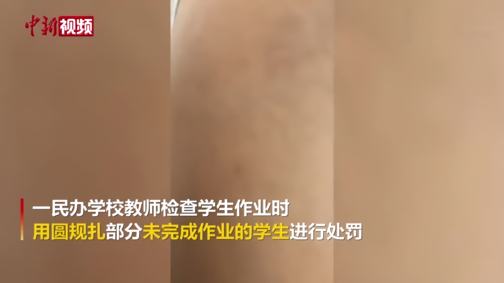 广东一老师用圆规扎未完成作业学生 已被警方控制调查