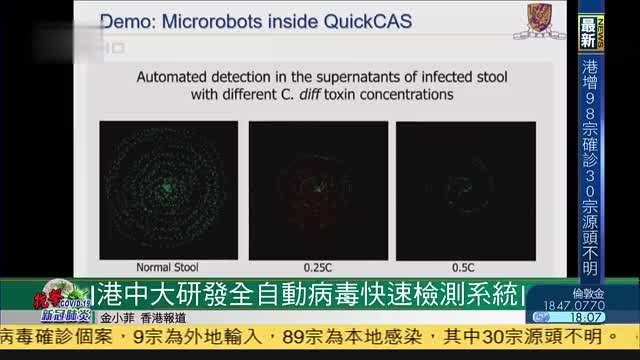 香港中文大学研发全自动病毒快速检测系统