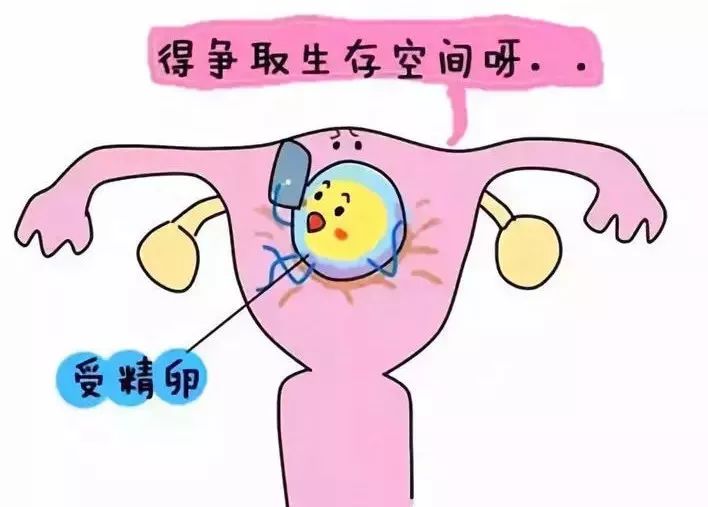 遇上宫腔粘连正发愁?其实可以这样治疗