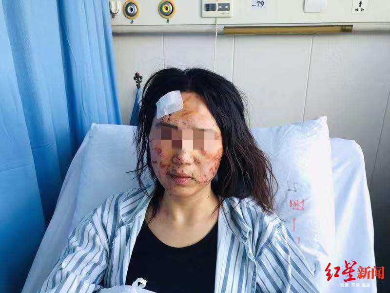 温州女子当街被公公丈夫暴打毁容涂排泄物！警方立案侦查（最新发布）