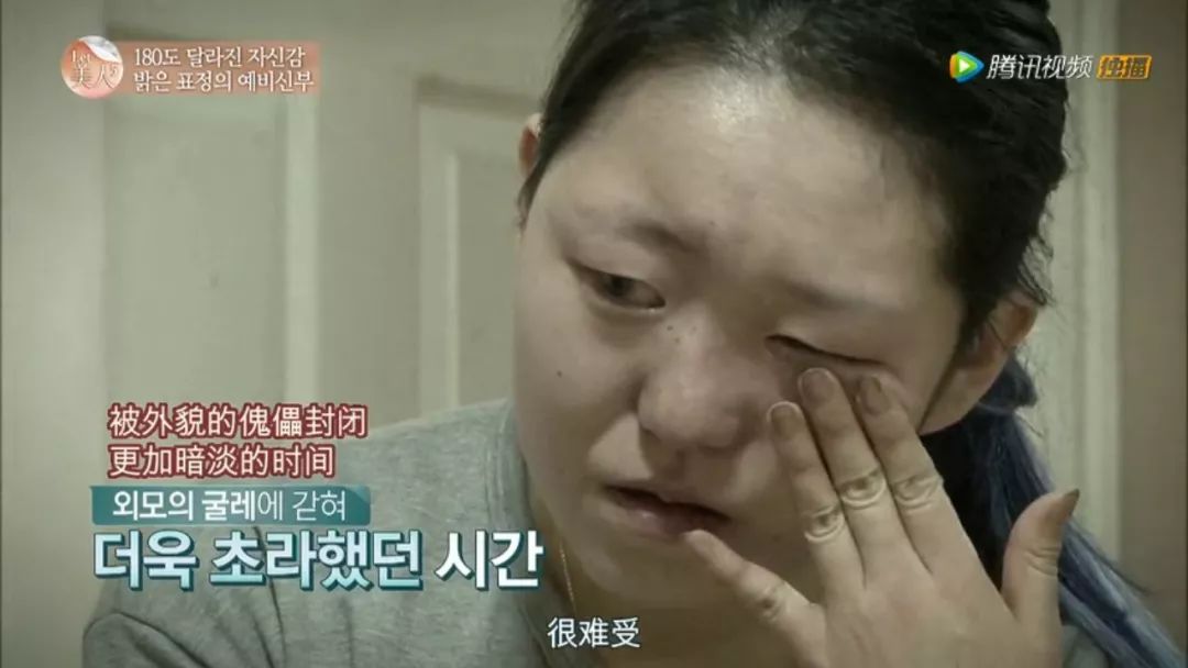 整容等于蛇精脸?这个帮人整容的节目却拯救了很多人的人生啊…