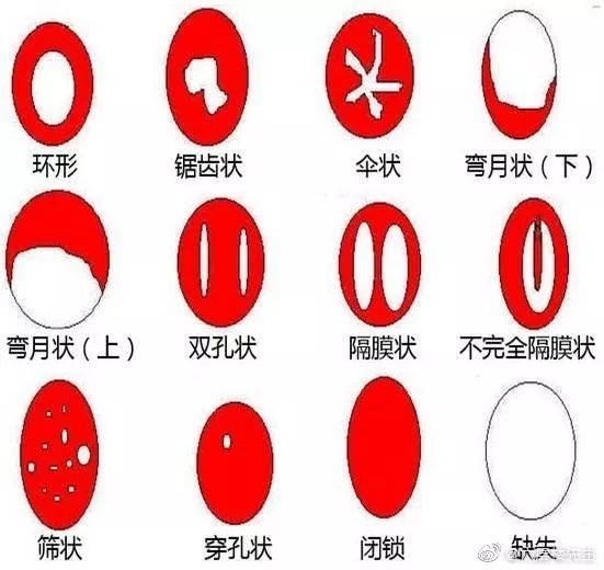 ��������ÿ���Ů����鴦ŮĤ�Ƿ����� ���ѣ���