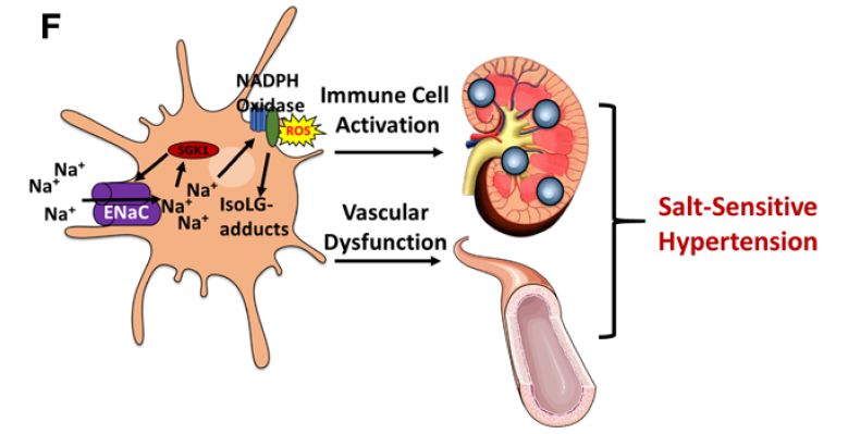 进展丨盐升高血压的机制或明了!sgk1有望成为治疗新靶点