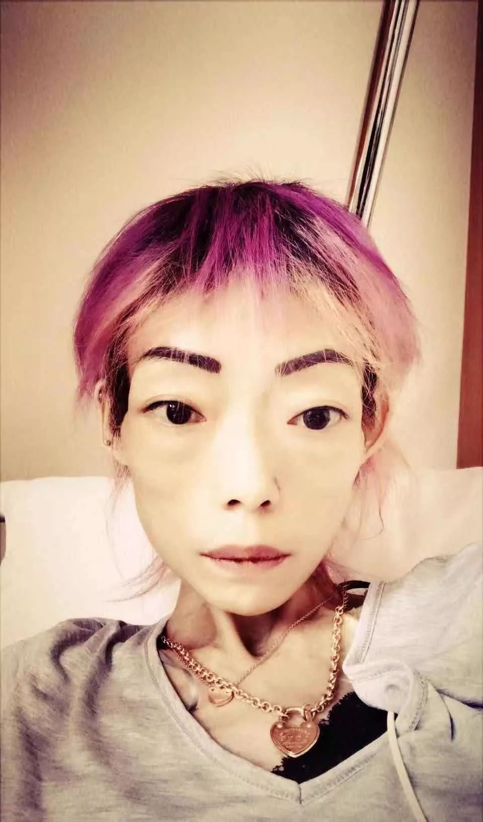 「不八卦会死星人」最惨正宫！遭抛弃牙齿全掉暴瘦到44斤，今病情严重卖收藏凑药钱