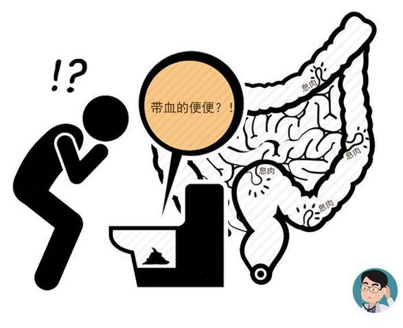 4,大便颜色发生改变
