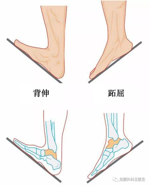 踝关节撞击症——脚踝里的对对碰