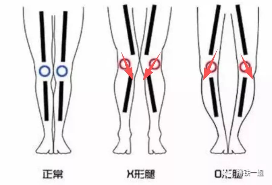 杨幂的x型腿是冻出来老寒腿?钟楚曦,热巴偷穿秋裤被发现超可爱