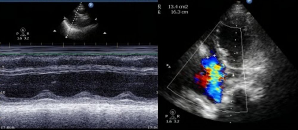 图1. 超声心动图.