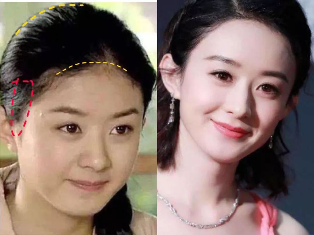 大部分女生这个部位的骨都没长好