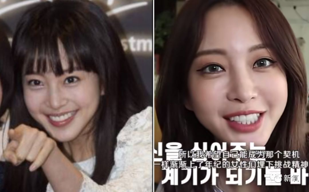 「新氧App」娱乐圈第一代人造美女近照，40岁不仅没崩还嫩过18岁