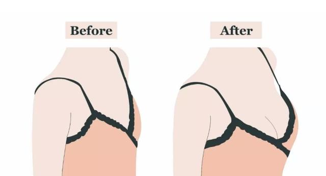 罩杯升级、乳房胀痛、变黑...... 孕期乳房这些变化正常吗?