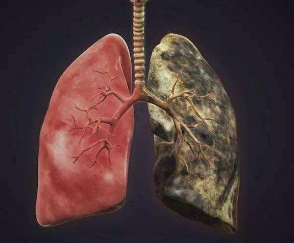 肺部的健康,对人体起着至关重要的作用,但是很多人却每天做着伤害
