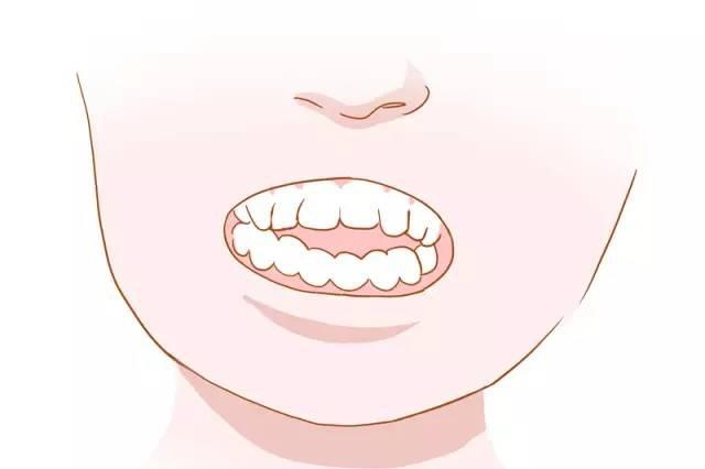 7.后牙反颌,锁颌:影响牙齿咬合功能,长期可能导致上下颌骨偏歪畸形.