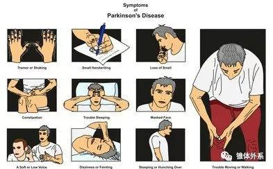帕金森病晚期表现——治疗帕金森病的药膳