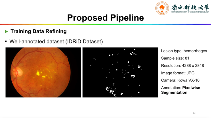南方科技大学唐晓颖:如何利用粗略标注的图像自动检测眼底病变?