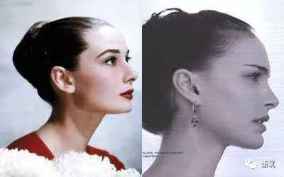 杨紫脸又变了?鼻基底假体厚到合不上嘴!变猴型