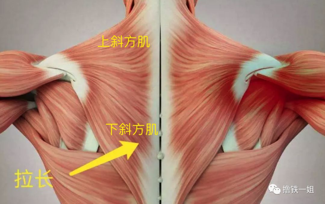 下斜方肌薄弱也会带着深层的菱形肌薄弱.