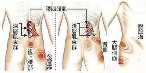 [11-11]腰痛?颈椎痛?你可能是得了这个病