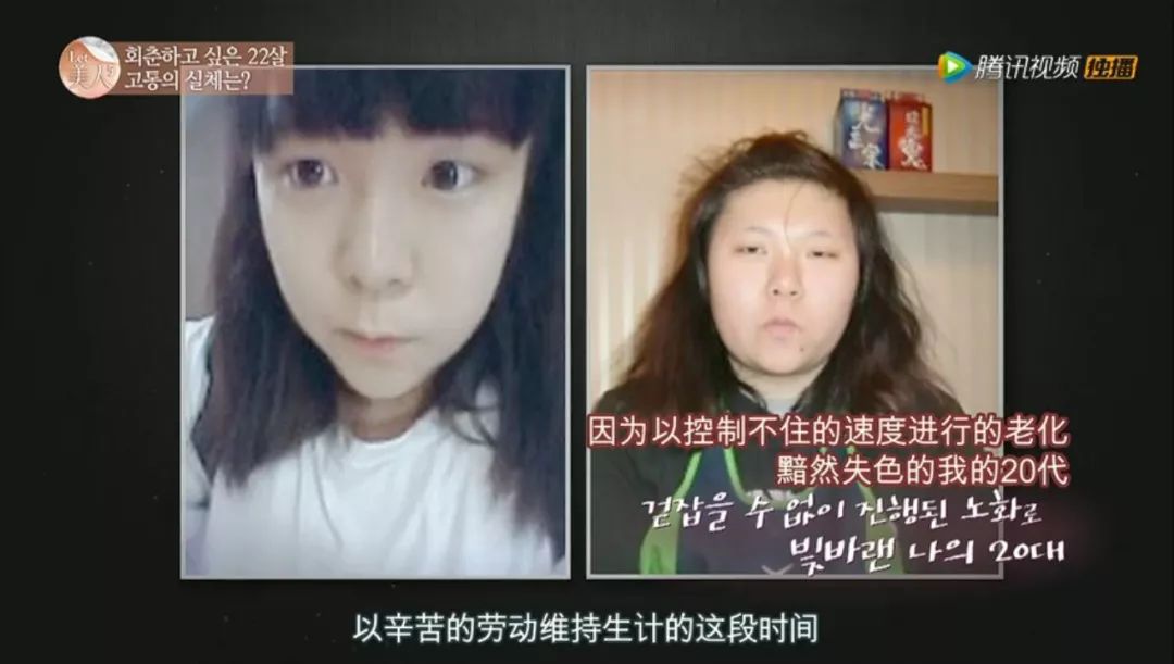 整容等于蛇精脸?这个帮人整容的节目却拯救了很多人的人生啊…