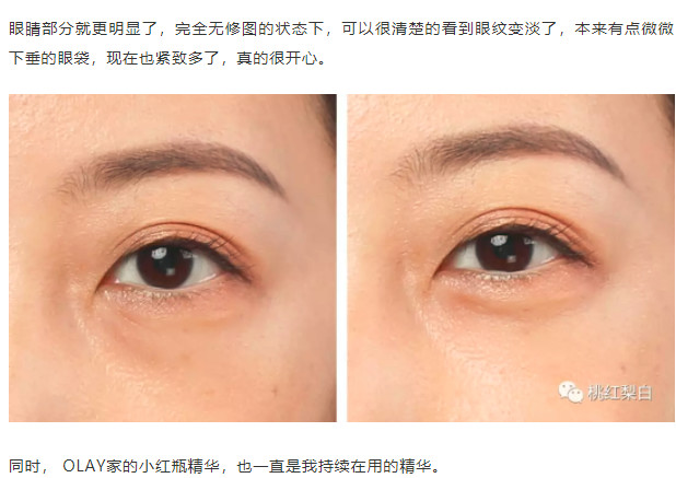 景甜这样的人间富贵花，最怕的是什么？