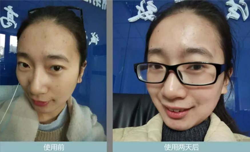 [钛媒体]清华学霸们做出2019年度抗衰“黑马”，28天还你美好肌肤