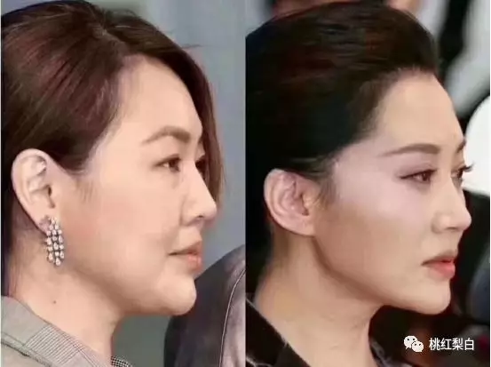 小S跟50岁的许晴颜值对比惨烈，天生尤物和后天美女究竟差在哪？
