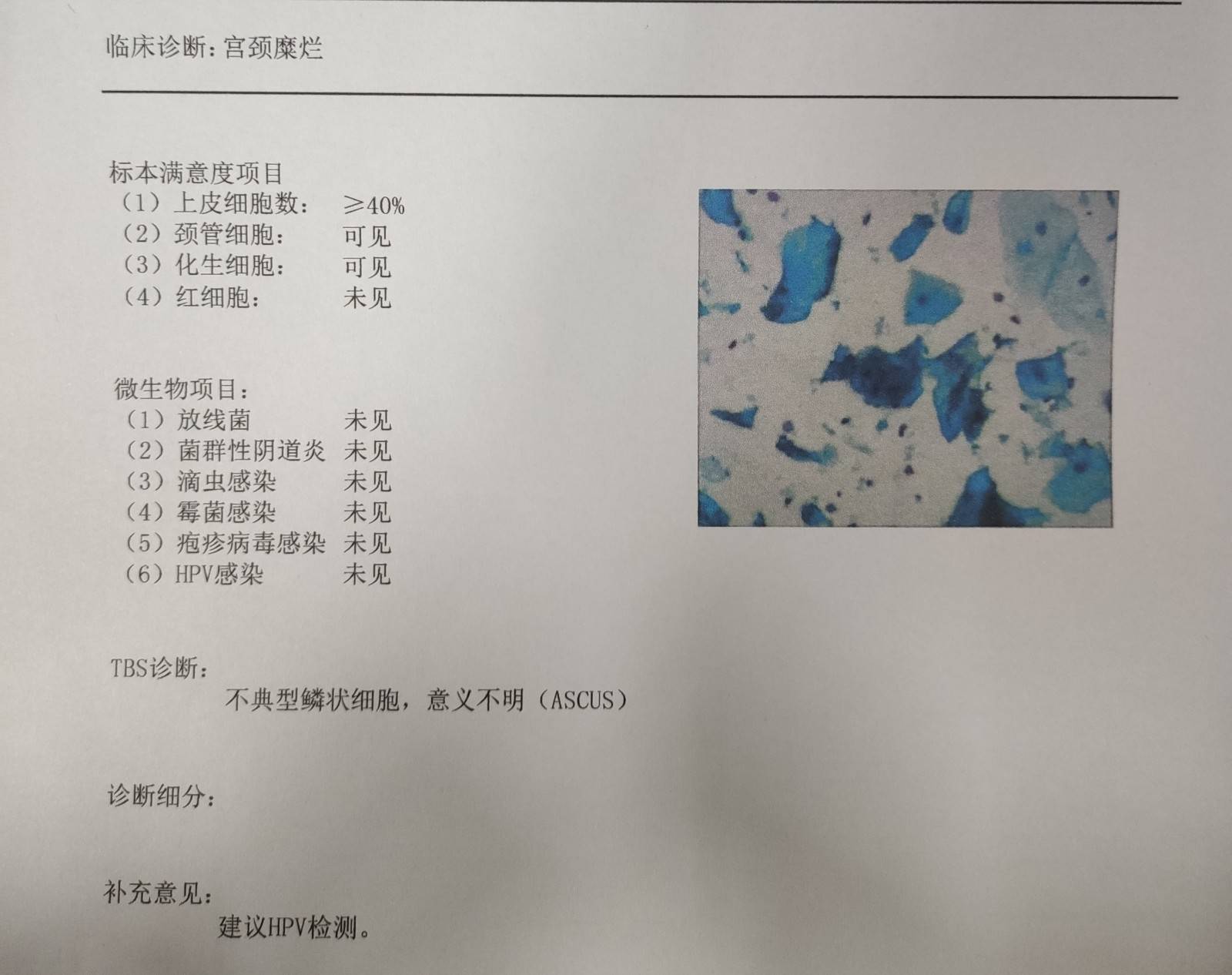 感染hpv六个月的转阴历程让我认识到健康的重要性