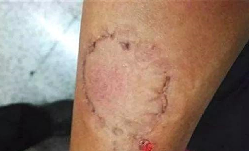 产妇分娩七天后捅死丈夫,月嫂称死者手臂都是咬痕"全因纵容"
