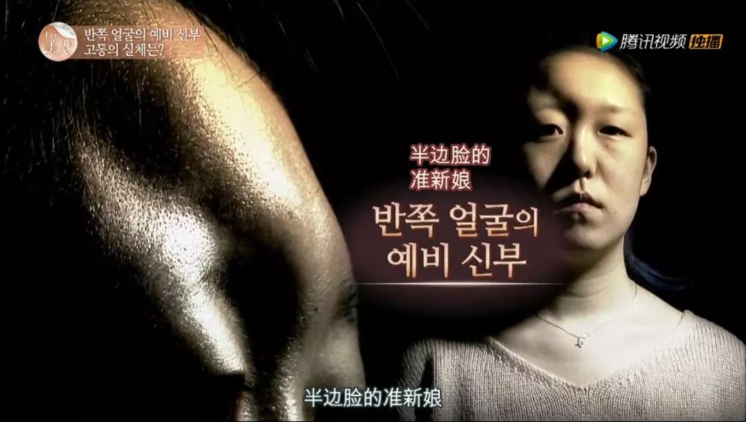 整容等于蛇精脸?这个帮人整容的节目却拯救了很多人的人生啊…