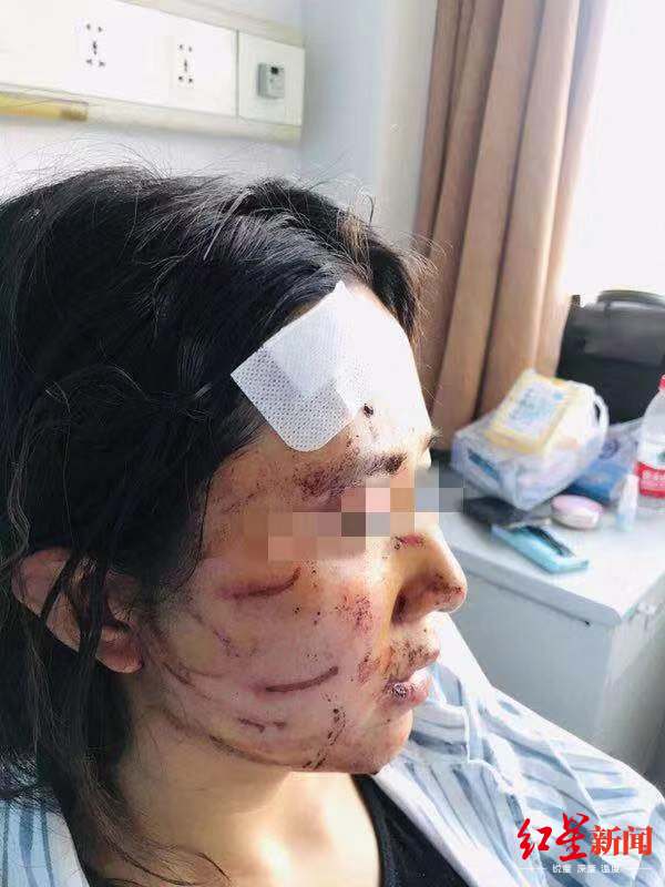 温州女子当街被公公丈夫暴打毁容涂排泄物！警方立案侦查（最新发布）