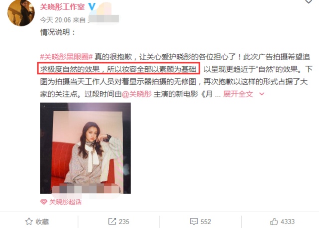 关晓彤回应黑眼圈是怎么回事?终于真相了,原来是这样!