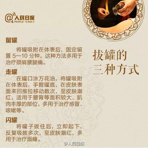 九,观察反应 十,拔罐时间 大型号罐具吸力强大,每次可留罐5～10分钟