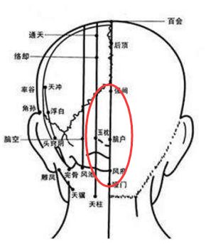 2,两侧疼又叫偏头疼(包括,太阳穴附近,及后脑勺偏两侧的位置),属少阳