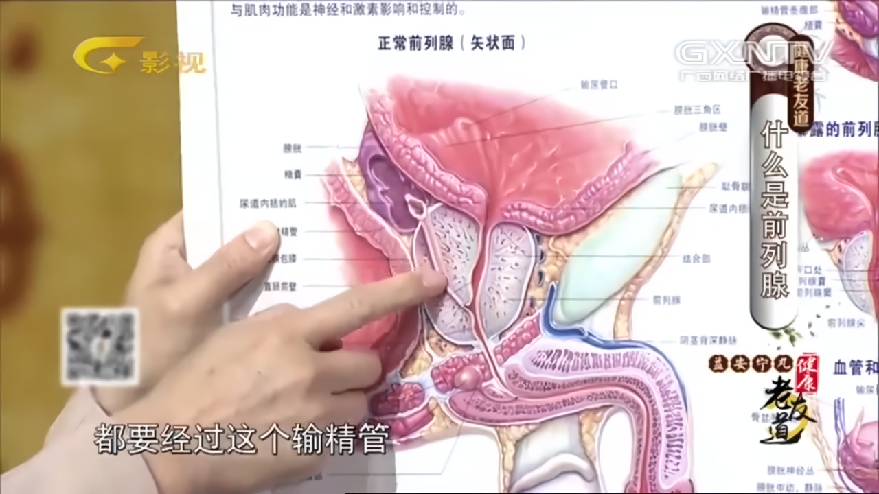前列腺增生需不需要治疗专家解释前列腺三大功能,早知道早受益