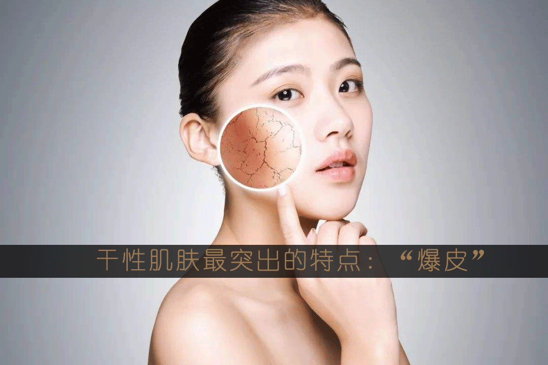 秋天,作为干性皮肤的你,如何快速地告别"爆皮",拥有水