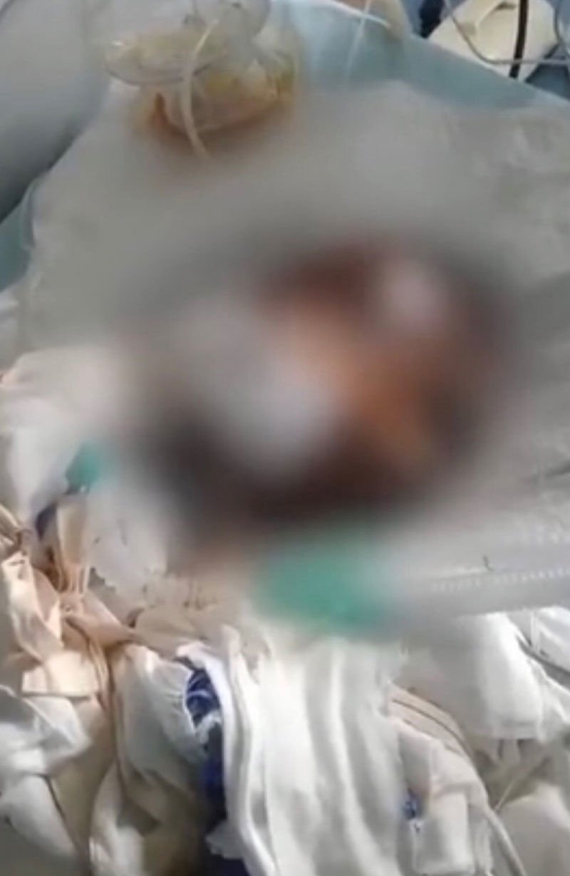 女孩模仿“易拉罐制爆米花”不幸离世 其父欲状告博主和平台