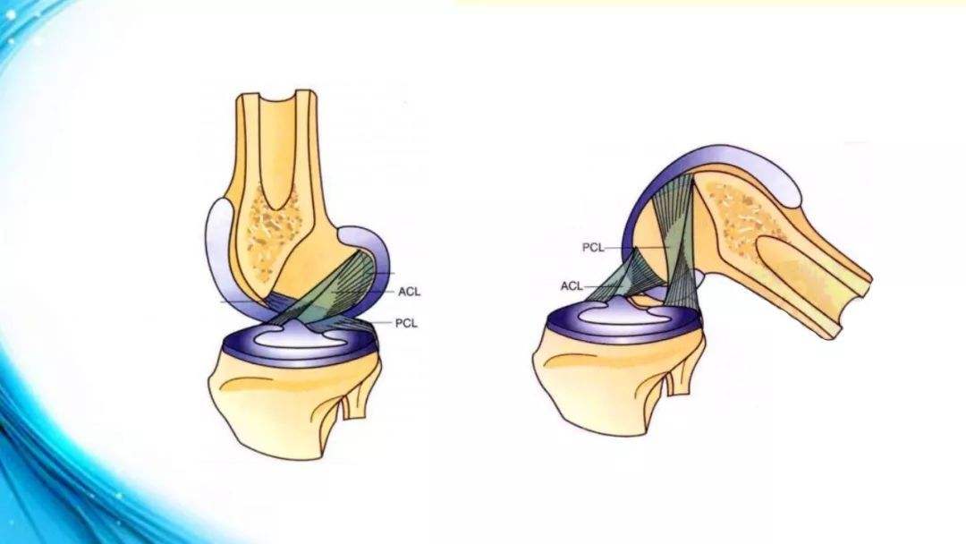 膝关节损伤|膝关节韧带损伤的治疗方法 膝关节韧带损伤如何处理