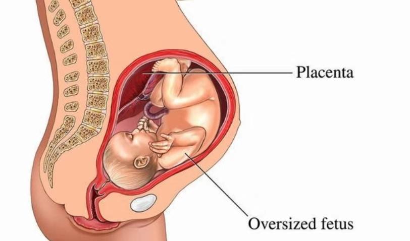 胎盘前壁与后壁有什么区别?这几种差异,孕妇多些了解早获益