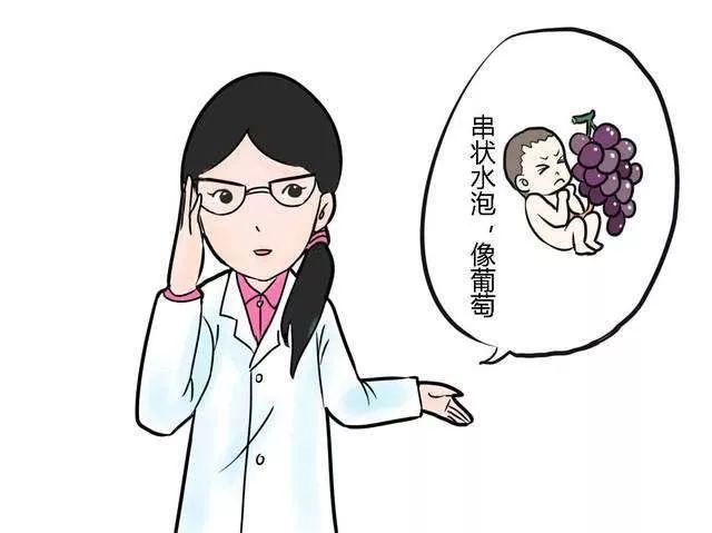 孕妈涨知识-葡萄胎科普