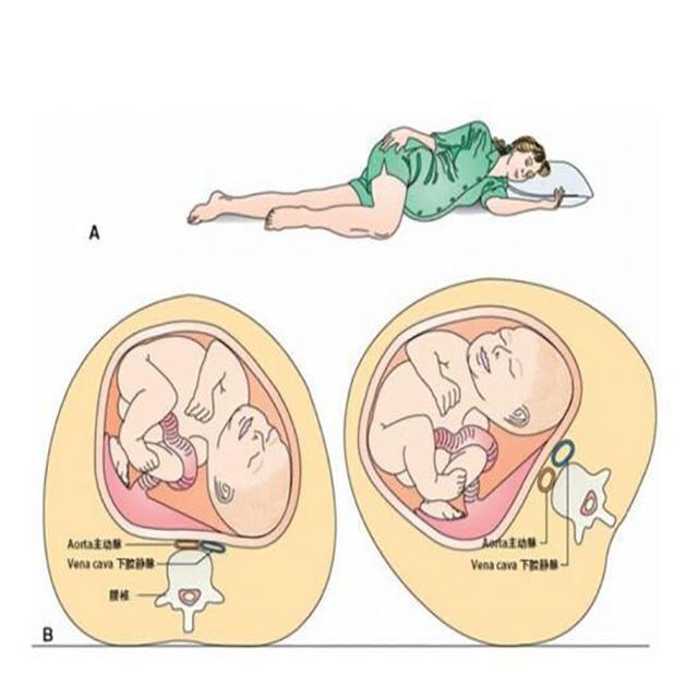 孕期孕妈妈左侧卧睡,胎儿胎动频繁,是胎宝宝不舒服吗?怎么办呢