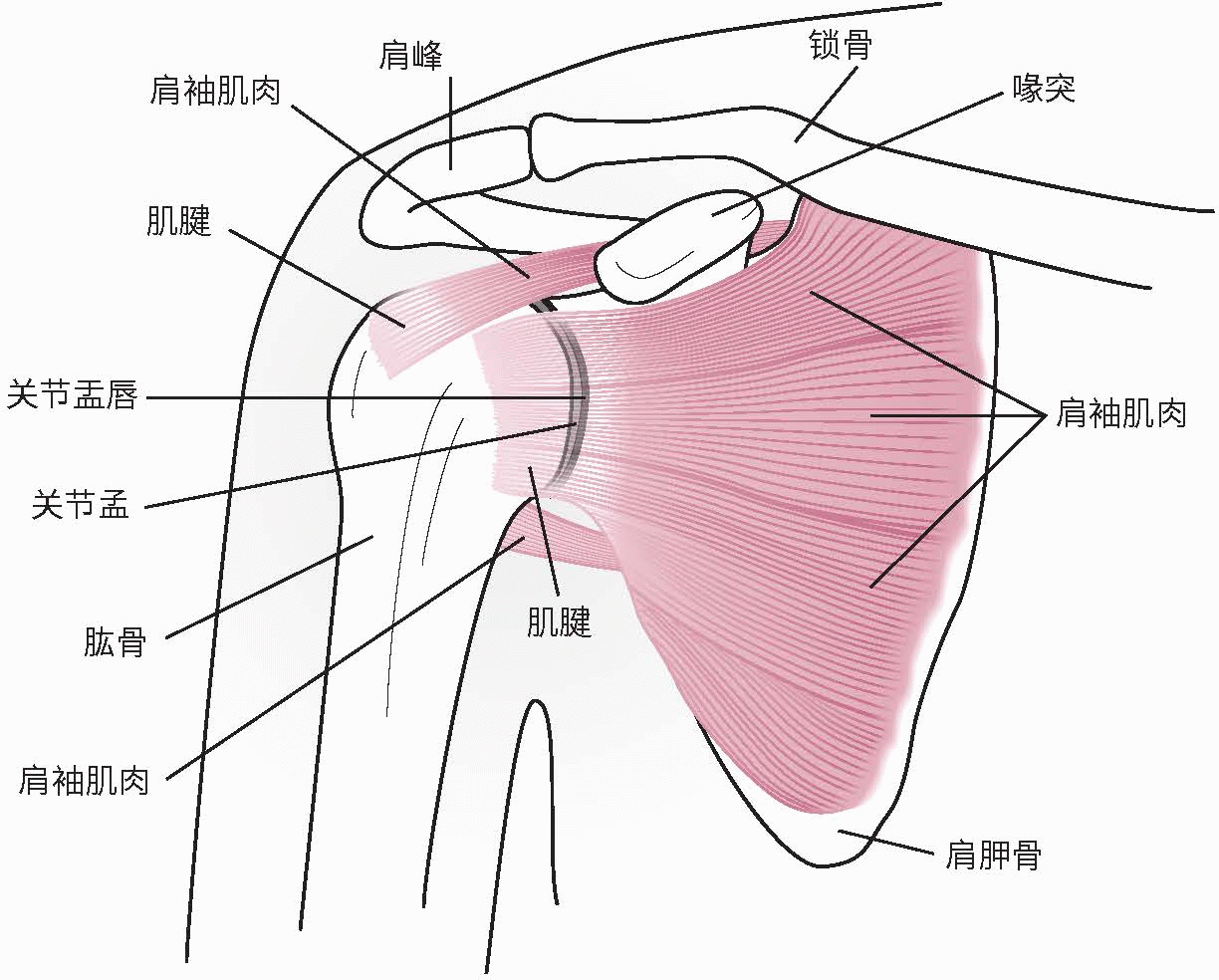 肩痛你很可能肩袖损伤了