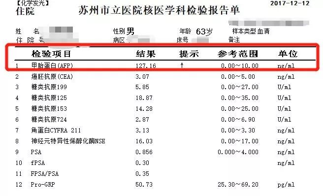 甲胎蛋白升高就是肝癌吗也许你一直错了