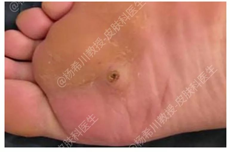 杨教授每周病例分享