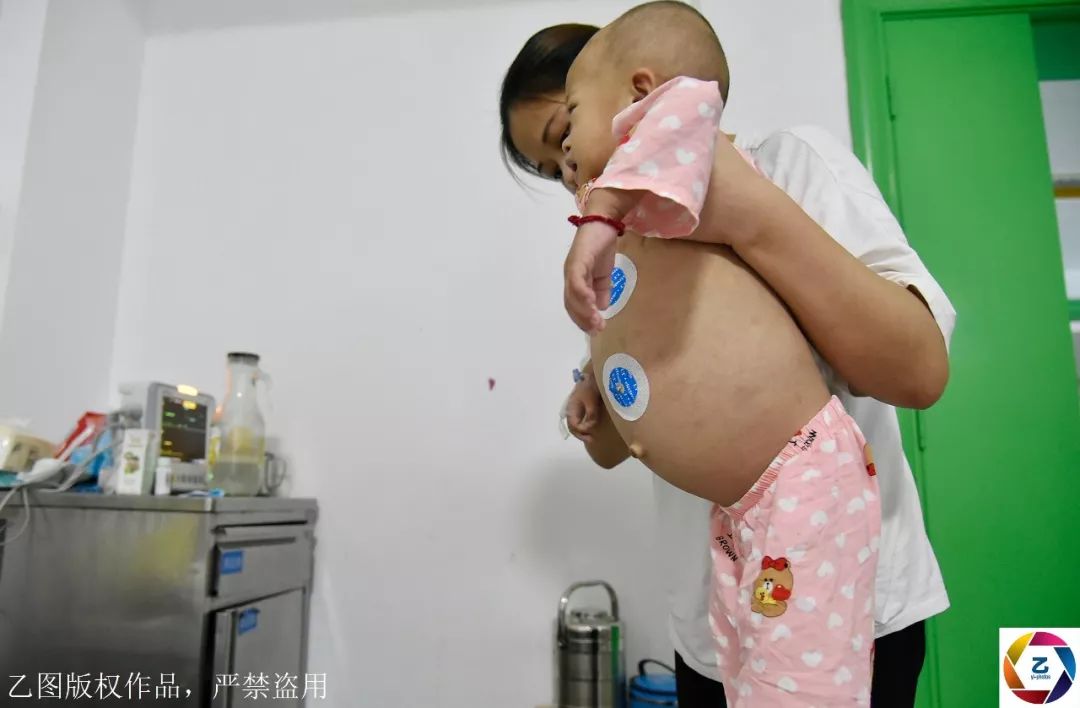 2岁女童肚子越来越大,每天喊痛,妈妈骗她肚子里有个"弟弟"