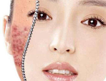 生理盐水敷脸的具体功效